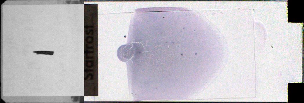 MGG